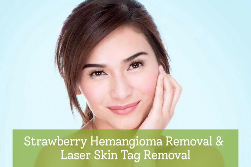 strawberryhemangiomafeatureimg Rainforest Medspa
